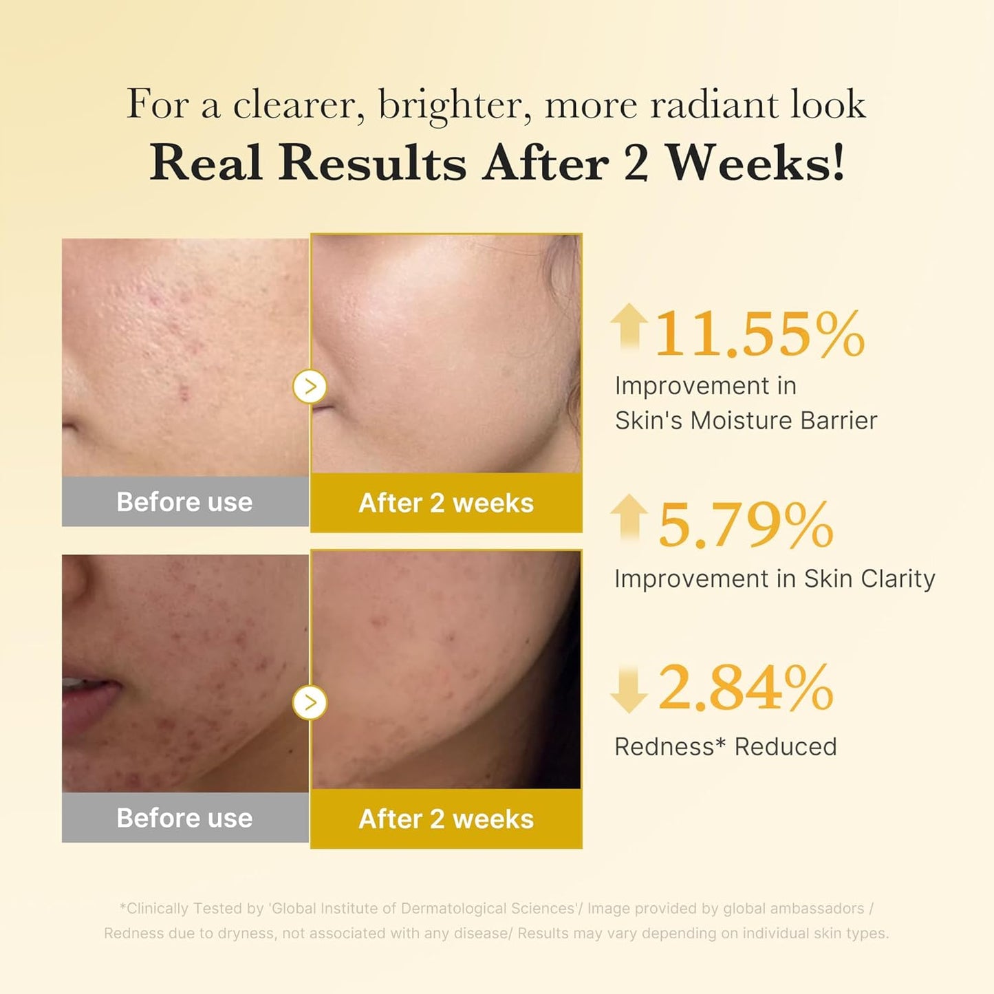 Kojic Acid Renew & Smooth Duo