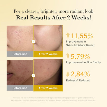 Kojic Acid Renew & Smooth Duo