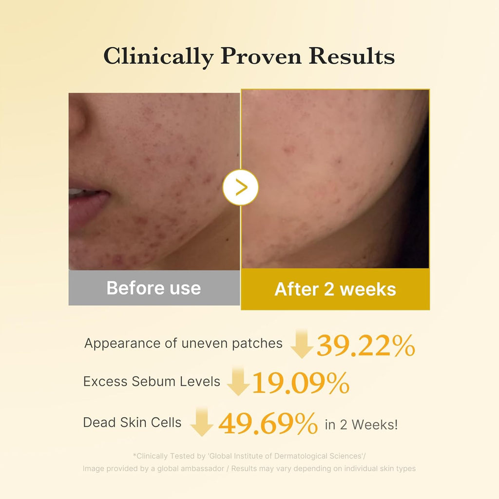 Kojic Acid Renew & Smooth Duo