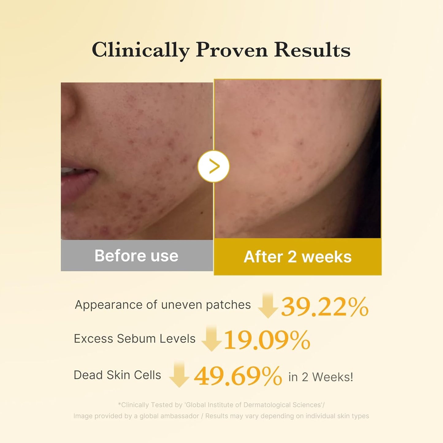 Kojic Acid Renew & Smooth Duo