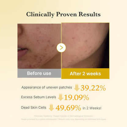 Kojic Acid Renew & Smooth Duo